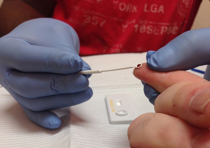 A HIV Rapid Test being administered 