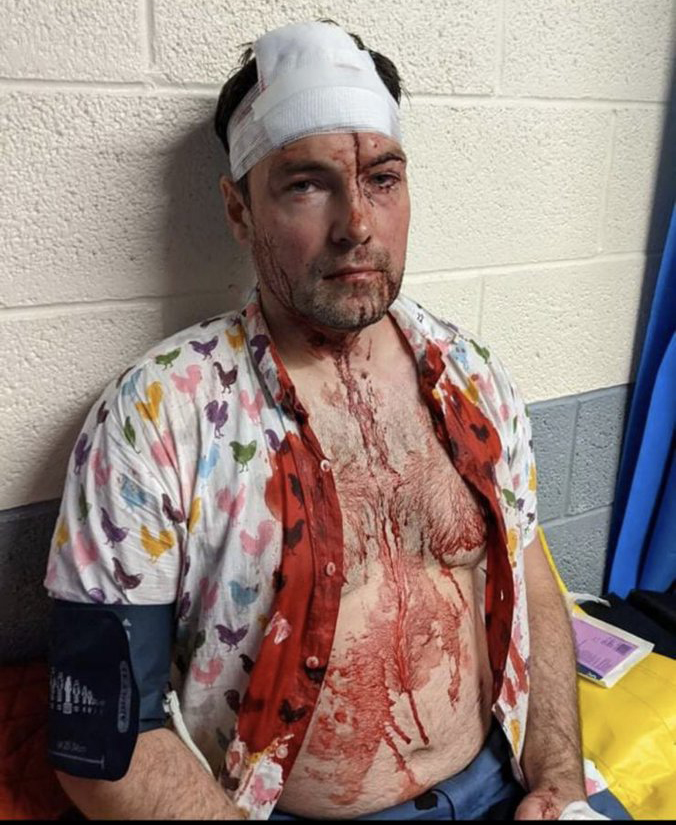 Rob covered in blood following the brutal and vicious homophobic attack 