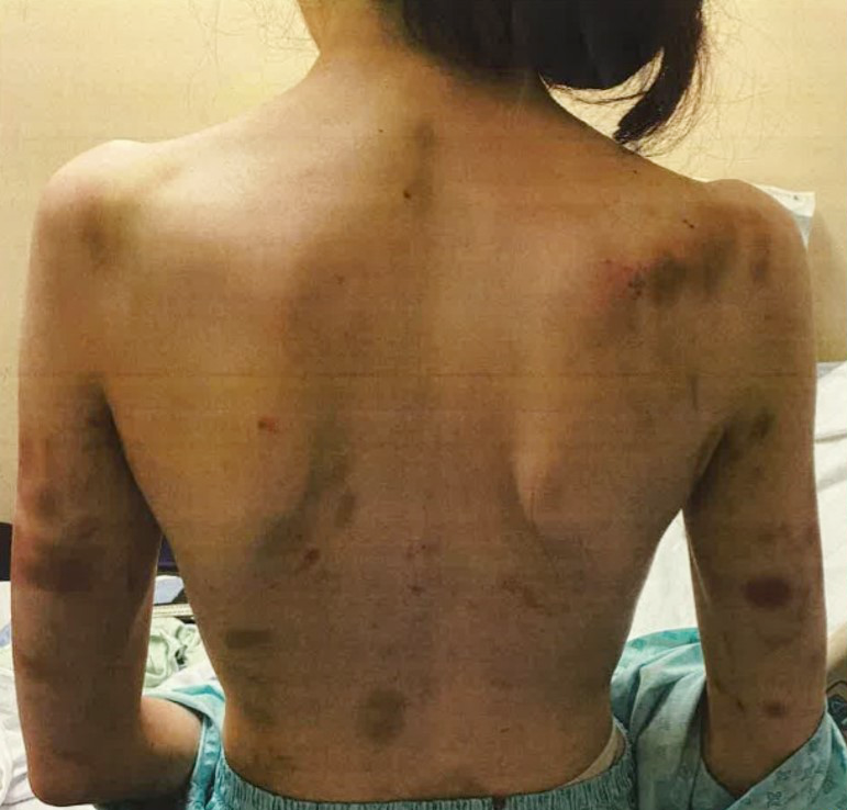 These photos, released with consent from the victim, show the extent of her injuries at the hands of Rory Farrell