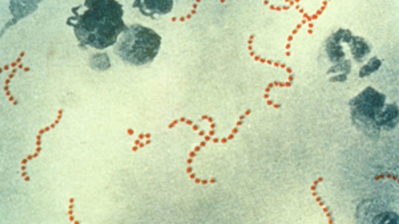 The UK Health Security Agency (UKHSA) has warned about the rise in scarlet fever and invasive group A strep cases